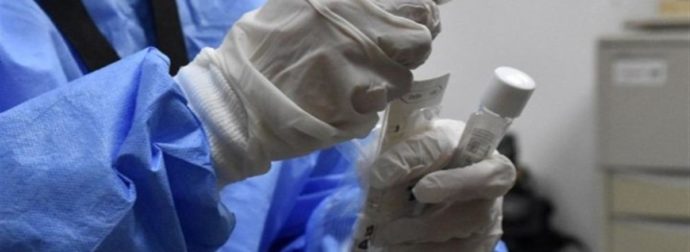 Κορωνοϊός – “Καζάνι που βράζει” η χώρα: 36.246 νέα κρούσματα – 78 θάνατοι και 615 διασωληνωμένοι
