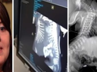 27χρονη έγκυος πήγε να κάνει υπερηχογράφημα – Όταν το είδαν οι γιατροί πάγωσαν και της είπαν να το ρίξει (Video)