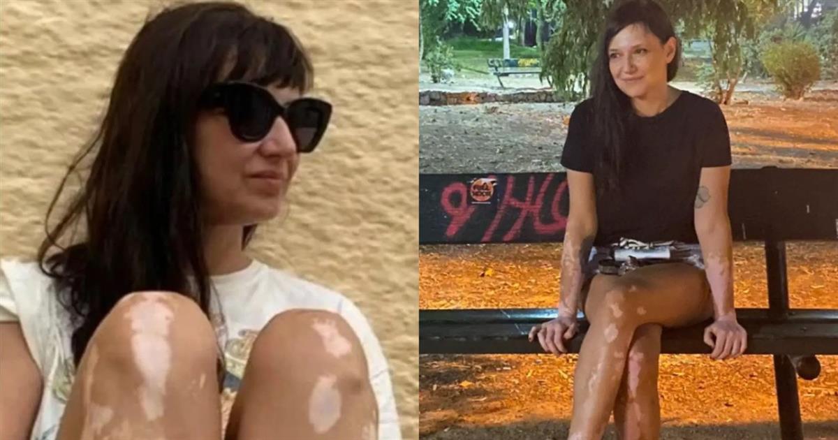 Αθηναΐς Νέγκα: «Αυτή είναι τελείως χάλια, απάισια με λεπρό δέρμα» – Το χυδαίο μήνυμα που δέχθηκε