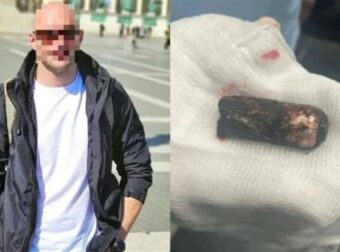 Επεισόδια στου Ρέντη: Δεύτερο κρίσιμο 24ωρο για τον 31χρονο αστυνομικό – Εσπευσμένα στην Αθήνα η οικογένειά του – Έχει χάσει πάρα πολύ αίμα