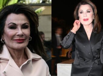 Πριν τις πλαστικές, τα μπότοξ & τα fillers: Μια άλλη η Γιάννα Αγγελοπούλου-Δασκαλάκη, οι φωτο που την “πρόδωσαν”