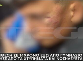 Με βαριές κρανιοεγκεφαλικές κακώσεις 14χρονος που δέχτηκε επίθεση από συμμαθητή του – «Μου λένε “κυρία, πεθαίνει ο μικρός”» (video)